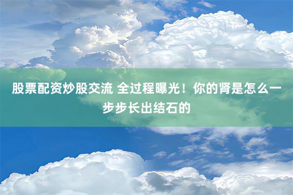 股票配资炒股交流 全过程曝光！你的肾是怎么一步步长出结石的