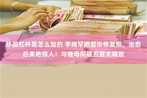 炒股杠杆是怎么加的 李嫣罕晒整形修复照，治愈后美艳惊人！与继母同框五官太精致